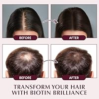 Yzmoffer Hair Growth Shampoo with Biotin and Rosemary, 10.5 Fl Oz — image 4