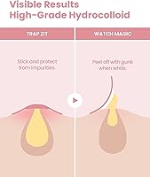 GLAM UP Hydrocolloid Blemish Pimple Zit Patches (180PCS) — image 2