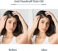 Blue Nectar Anti Dandruff Hair Oil with Neem & Tea Tree, 6.76oz — image 4