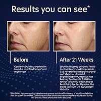 PCA SKIN Vitamin B3 Brightening Serum 1.0oz — image 8