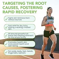 Thena Athlete’s Foot Cream 2oz — image 2