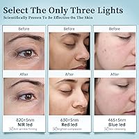 GYH Cloud-SS RB-030 LED Face Mask — image 5