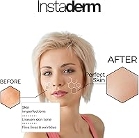 Instaderm Complexion Renewal Pads – 60 Count — image 4