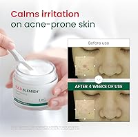 Dr.G Red Blemish Clear Soothing Cica Cream 70mL — image 3