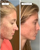 Averr Aglow Clear Skin Elixir — image 7