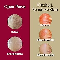 LABO Nutrition Le Revital 98% Nano Placenta Extract Serum — image 4