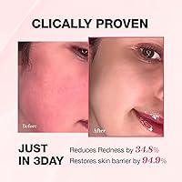 Physiogel Redness Reducing Cream 5.07oz — image 5