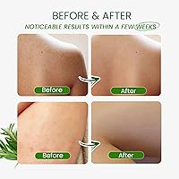 PHARMBANNER Tea Tree Antifungal Body Wash, 11.84oz — image 5