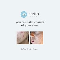 Perfect Image Tri-Clarity Peel Pads 25% Strength — image 8