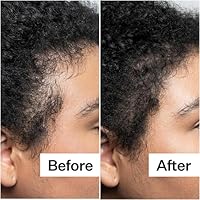 Makof Beauty Chebe Hair Growth Oil, 5oz — image 7