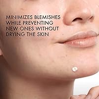 Vichy Normaderm S.O.S Acne Rescue Spot Corrector, 10% Sulfur, Niacinamide & Glycolic Acid — image 4