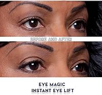 Eye Magic Premium Eye Lift (S/M Kit + Gel) — image 8