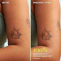 Fur Ingrown Hair Oil 14mL — image 6