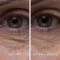 ELEMIS Peptide4 Eye Recovery Cream 0.5 Fl Oz — image 4