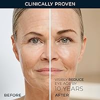 RoC Retinol Correxion Under Eye Cream, 0.5oz — image 4