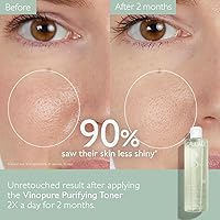 Caudalie Vinopure Natural Salicylic Acid Pore Minimizing Toner 6.7oz — image 2