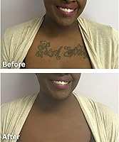 Dermaflage Tattoo Cover Up Makeup (Dark) — image 4