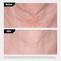 Revision Skincare Nectifirm® Neck Cream 1.7oz — image 6