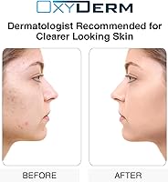 OxyDerm Sulfur Purifying Clay Mask — image 5