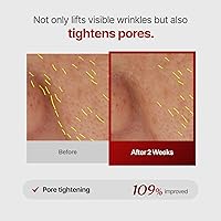 MEDITHERAPY Wrinkle-fit Mask + Facial Roller 7 Pack — image 6