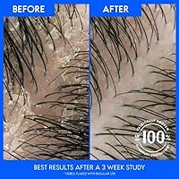 Head & Shoulders Deep Moisture Anti-Dandruff Shampoo with Avocado Oil 12.5oz (Pack of 2) — image 8