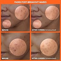 innisfree Green Tea Enzyme Vitamin C Toner Pads — image 4