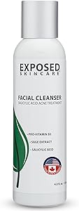 Exposed Skin Care Acne Facial Cleanser 4oz Review