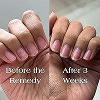 Botanist The Remedy Nail Strengthening Polish (Rose) — image 4