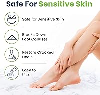 FOOT CURE Exfoliator & Callus Remover Pedicure Set – 4 Piece — image 7