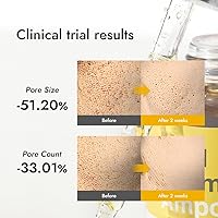 MIZON Real Vitamin C Ampoule 19% Pure Vitamin C 1.01 fl oz — image 8