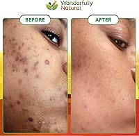 Wonderfully Natural Organic African Black Soap 1lb Bar — image 4