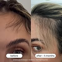 BONDIBOOST Procapil Scalp Treatment 4.23oz — image 4