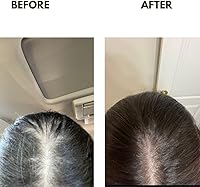 ZAIN1 Natural Hair Growth Serum 3.4oz — image 4