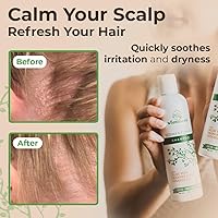 Wild Naturals Eczema & Psoriasis Shampoo 8oz — image 6