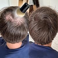 Keratin Research Hairline Filler Warm Medium Brown XL — image 3