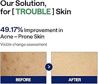 Mediheal Teatree Trouble Facial Toner Pads, 100 Pads — image 4