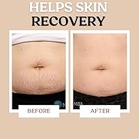 Roe Wellness Stretch Mark Cream for Sensitive Skin 13.3oz — image 5