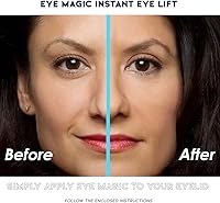 Eye Magic Premium Eye Lift (S/M Kit + Gel) — image 4
