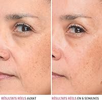 IT Cosmetics Bye Bye Lines Hyaluronic Acid Serum - 1 fl oz — image 2