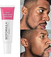 Stop Guessing The Fast Dark Spot Remover — image 2