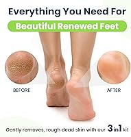 Foot Cure Callus Remover Gel & Pumice Stone Set — image 5