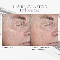 SkinMedica HA5 Rejuvenating Hydrator 2 Oz — image 6