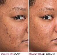 IT Cosmetics Bye Bye Dark Spots Niacinamide Serum 1oz — image 2