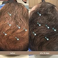 DS Labs Spectral Men’s Hair Density Serum 60mL — image 4