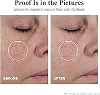 HKH Triple Vitamin C Dark Spots Correction Capsules Serum — image 6