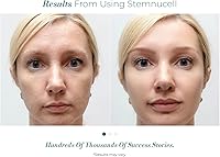 Solvaderm Stemnucell Anti-Aging Facial Serum — image 5