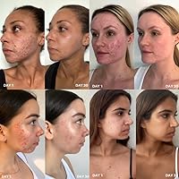 Clinisoothe+ Skin Purifier 3.4oz Spray — image 9