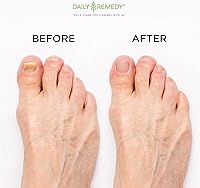 Daily Remedy Extra Strength Tea Tree Oil Foot Soak with Epsom Salt - 2 Pack — image 5