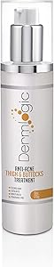 Dermlogic Anti-Acne Thigh & Buttocks Treatment 6.09oz Review