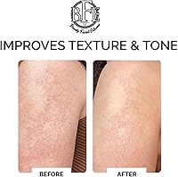 Beauty Facial Extreme Keratosis Pilaris Exfoliating Body Lotion 12% Lactic Acid 400mL — image 5